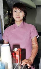 台湾被烧伤的明星,勇敢面对挑战的励志故事